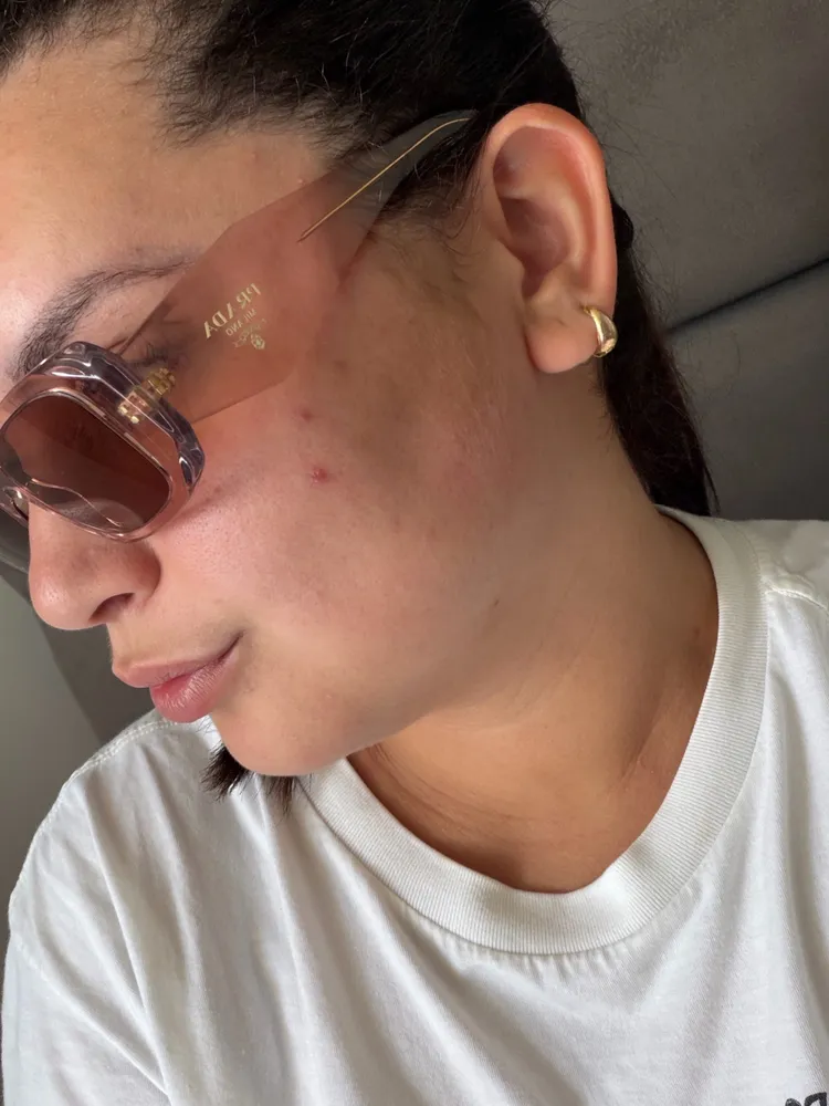 oculos Rosa Prada